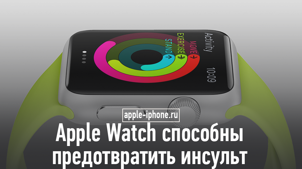 Apple Watch отслеживает ненормальный сердечный ритм с точностью 97%