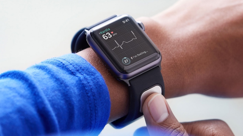AliveCor KardiaBand — первый медицинский аксессуар для Apple Watch