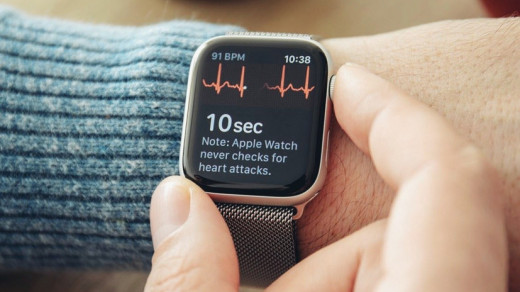 ЭКГ в Apple Watch